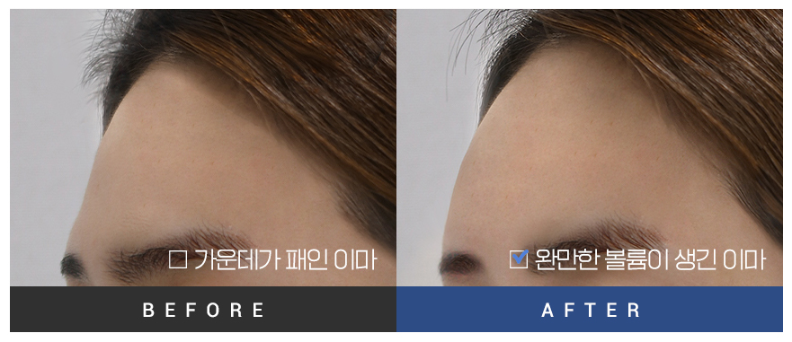 전후사진