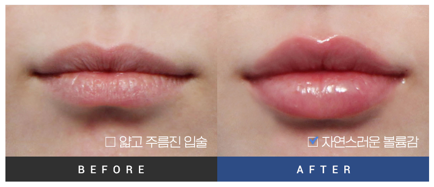전후사진