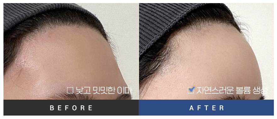 전후사진