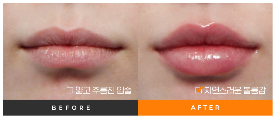 전후사진