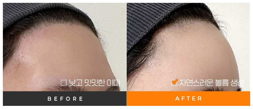 전후사진