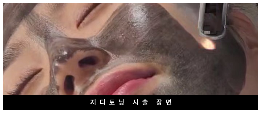 전후사진